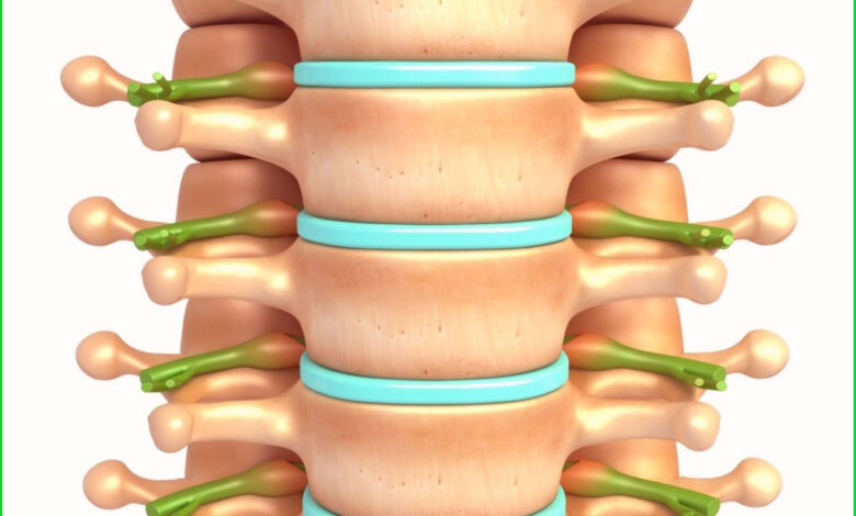 علاج انزلاق الفقرات بالاعشاب