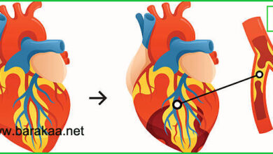 علاج ضعف عضلة القلب بالاعشاب
