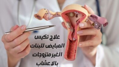 علاج تكيس المبايض للبنات الغير متزوجات بالاعشاب