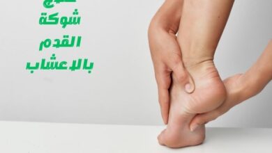 علاج شوكة القدم بالاعشاب