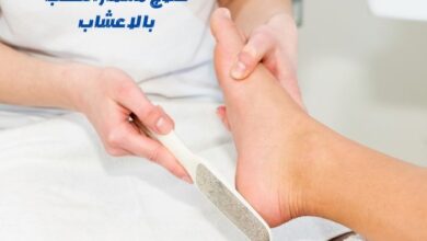 علاج مسمار الكعب بالاعشاب