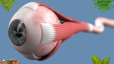 علاج تلف العصب البصري بالاعشاب