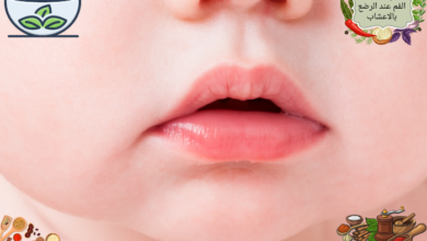 علاج فطريات الفم عند الرضع بالاعشاب