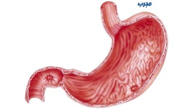 علاج قرحة المعدة بالاعشاب مجرب