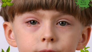 امراض العيون وعلاجها بالاعشاب