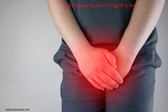 علاج الالتهابات الجلدية للعضو الذكري تخلص من التهابات العضو الذكري نهائيا