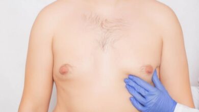 علاج تصغير الثدي عند الرجال بالاعشاب
