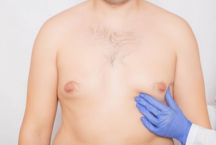 علاج تصغير الثدي عند الرجال بالاعشاب
