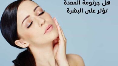 هل جرثومة المعدة تؤثر على البشرة